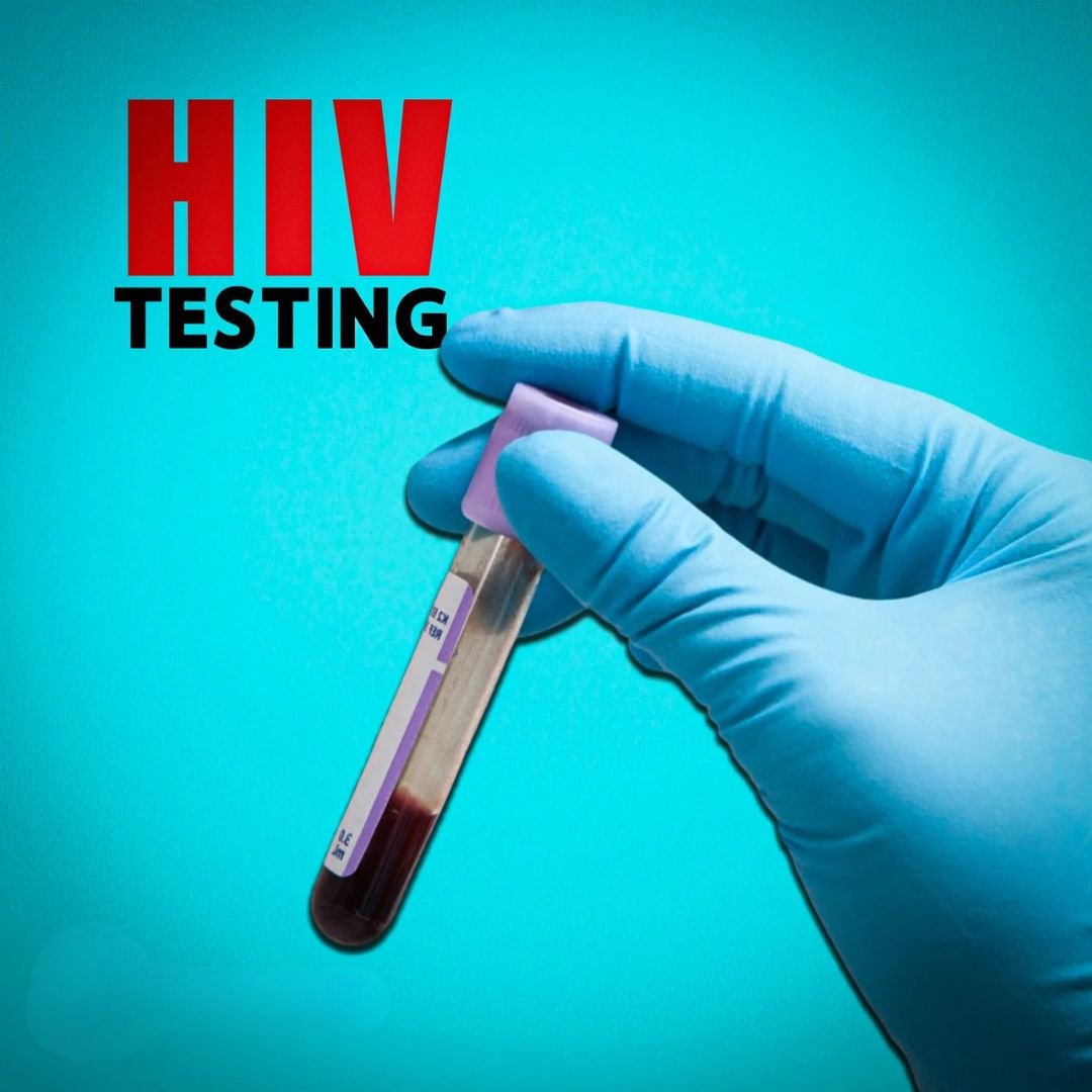 HIV Test